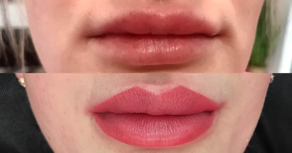 Jak zażywać heviran przed makijażem permanentnym ust, aby uniknąć problemów